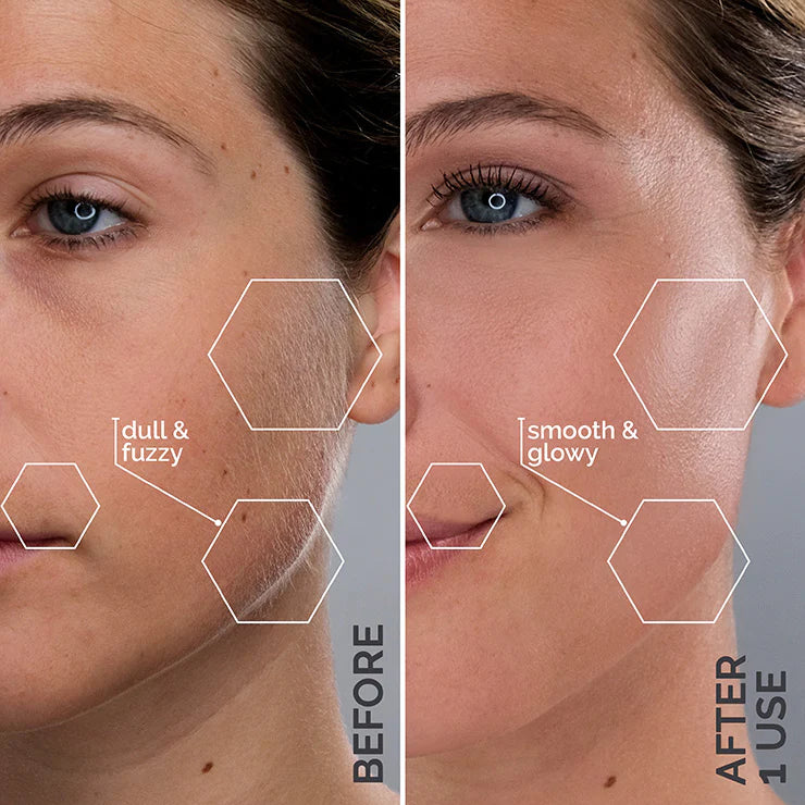 Before and after photos of a woman's face after using Spa Sciences' SIMA Deluxe Dermaplaning Kit.