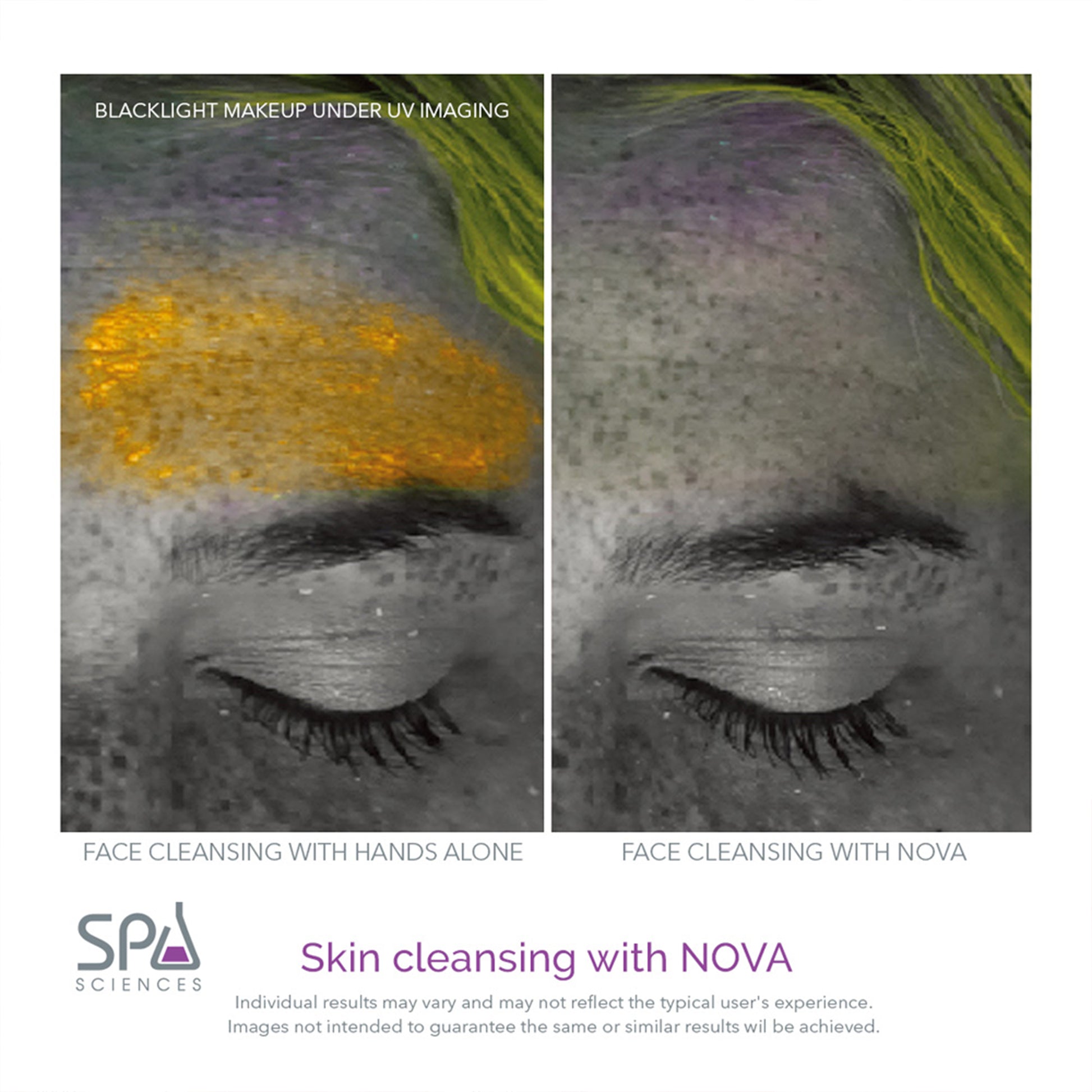 Cleanse your skin with the powerful Spa Sciences NOVA sonic cleansing brush for an effective and safe cleansing experience, thanks to its antimicrobial protection.
