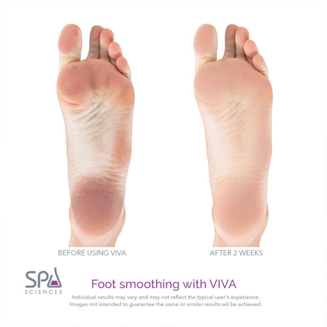 Smooth your feet at home with the Spa Sciences VIVA Bundle - BONUS Course & Fine Pedi Heads. Perfect for a DIY home pedicure, this callus remover will leave your feet feeling soft and silky.